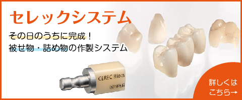 セレックシステム
