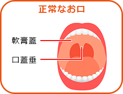 こんなお口の方も要注意です